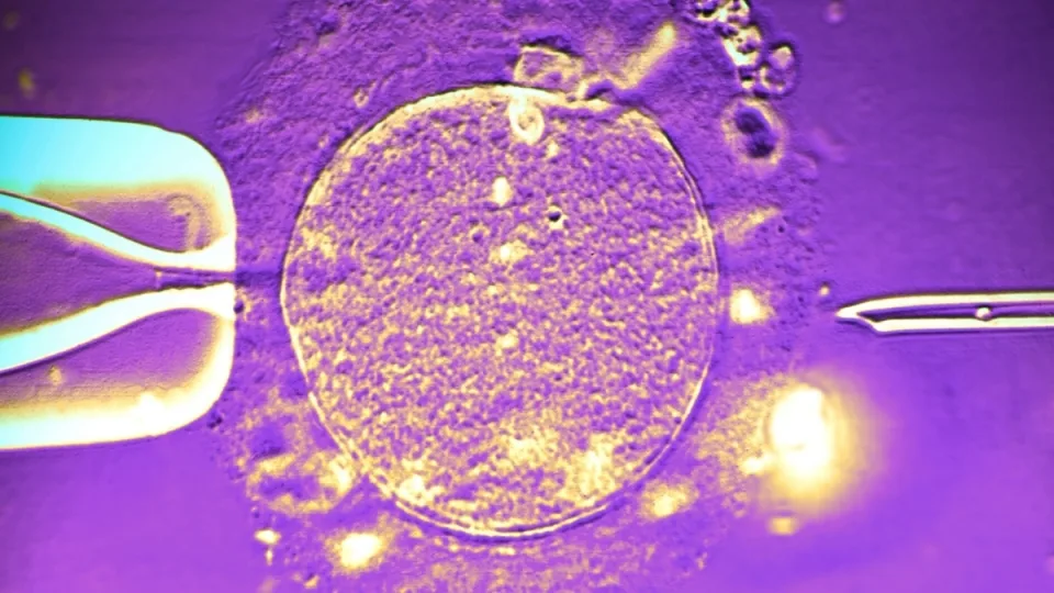 Tylus genetinis paveldas: kritinė spermos donoro klaida, dėl kurios kenčia šimtai šeimų