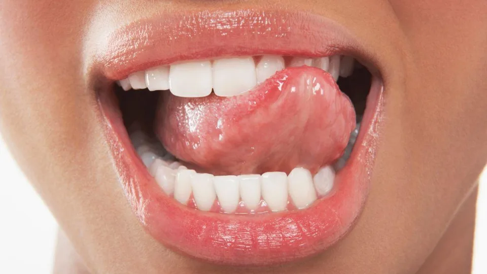 Proveržis odontologijoje: nutildytos „plepios“ bakterijos užkerta kelią ėduonies vystymuisi