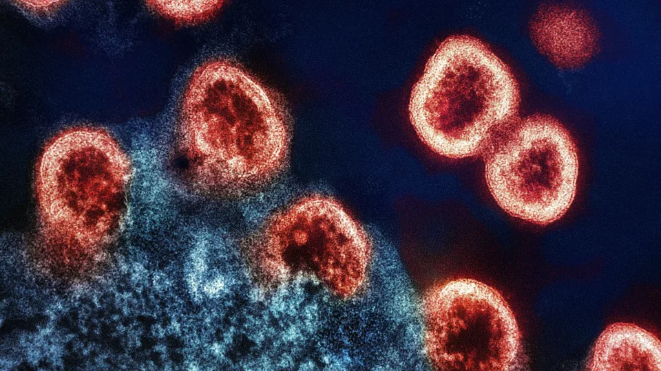 Pasveikote, bet pavojus liko? Mokslas atskleidė nerimą keliančius COVID pėdsakus