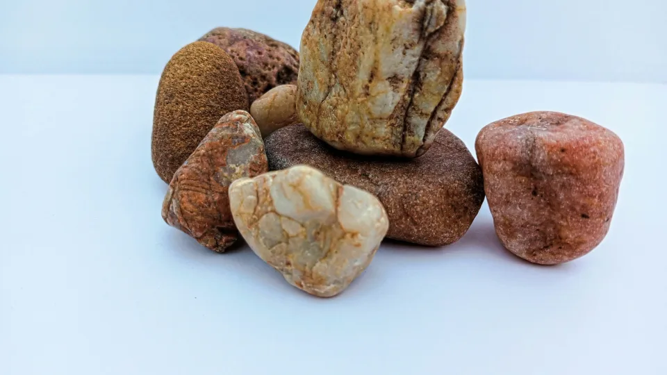 Šokiruojantis atradimas: inkstų akmenys nėra tokie nekenksmingai, kaip manėme iki šiol