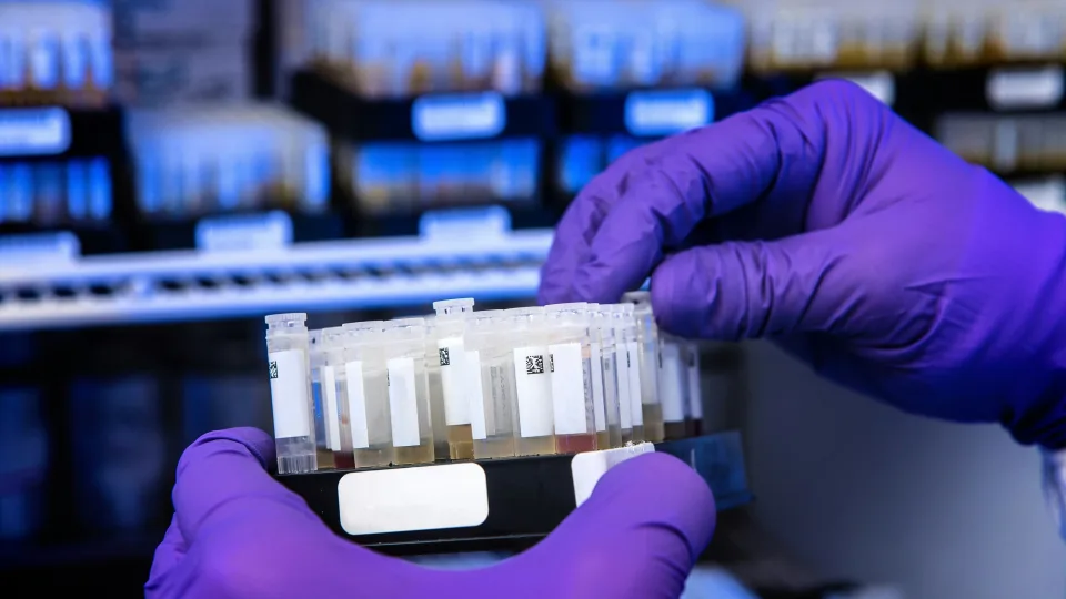 Revoliucinis atradimas medicinoje: naujas testas padeda nustatyti retas ligas vos iš vieno kraujo lašo