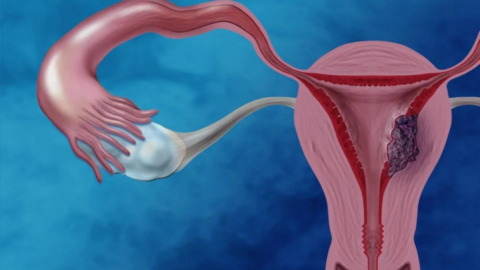 Endometriumo vėžio priežastis tyrinėjanti būsima mokslininkė: „Vėžio biologija susidomėjau dar mokykloje“