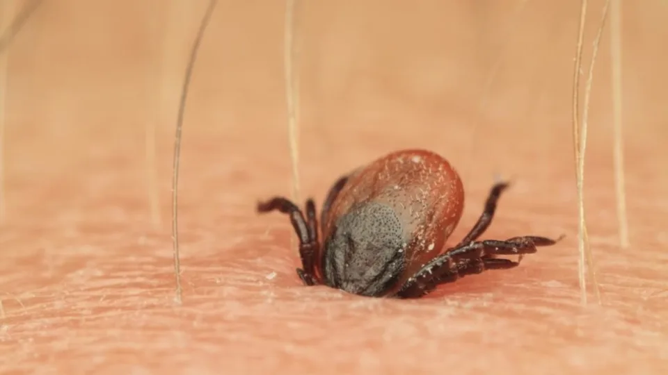 Po erkės įsisiurbimo praėjo savaitė: ne kiekviena erkė pavojinga, bet šių ženklų ignoruoti negalima