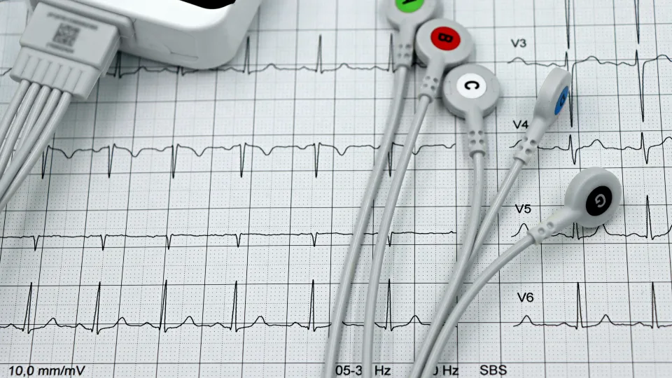 KTU su partneriais kuria federalinį dirbtinio intelekto modelį, tikslesnei širdies ligų diagnostikai ir gydymui