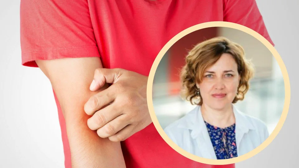 Kaip atskirti dilgėlinę nuo kitų ligų? Gydytojai paaiškino, kada tai slepia rimtesnę ligą nei galvojate