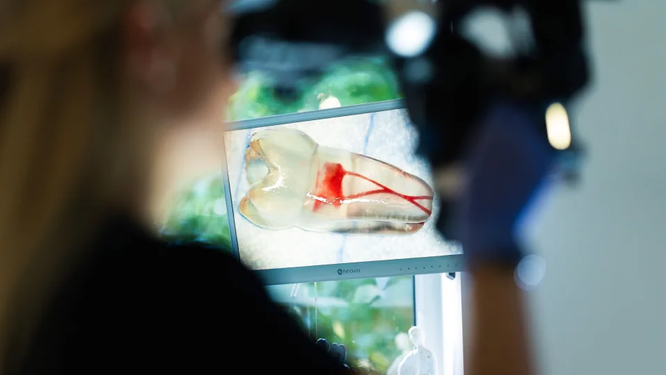 Šis gydymas dažnai lieka nesuprastas: sužinokite, ką iš tiesų veikia gydytojas endodontologas