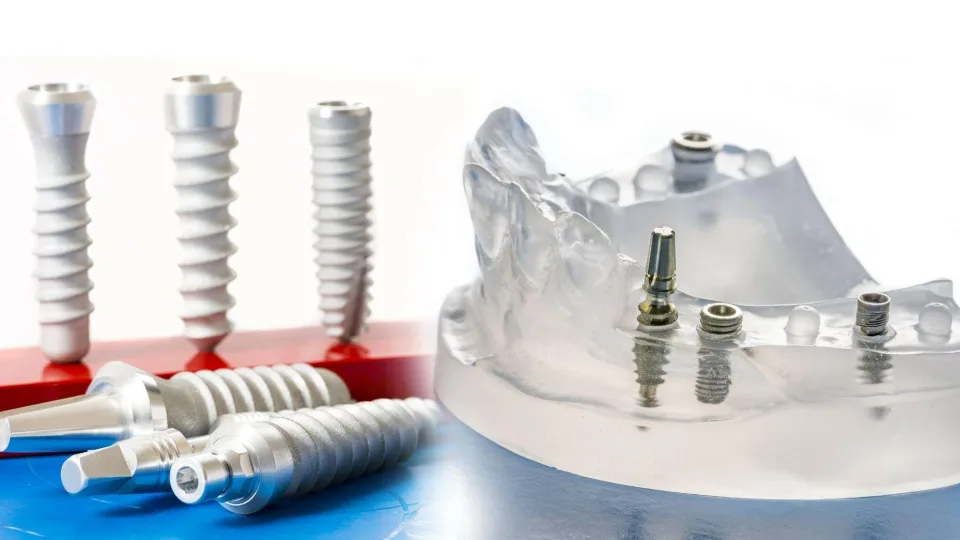 Ar dantų implantai iš tiesų gali tarnauti visą gyvenimą? Gydytojas paaiškino, kaip yra iš tikrųjų