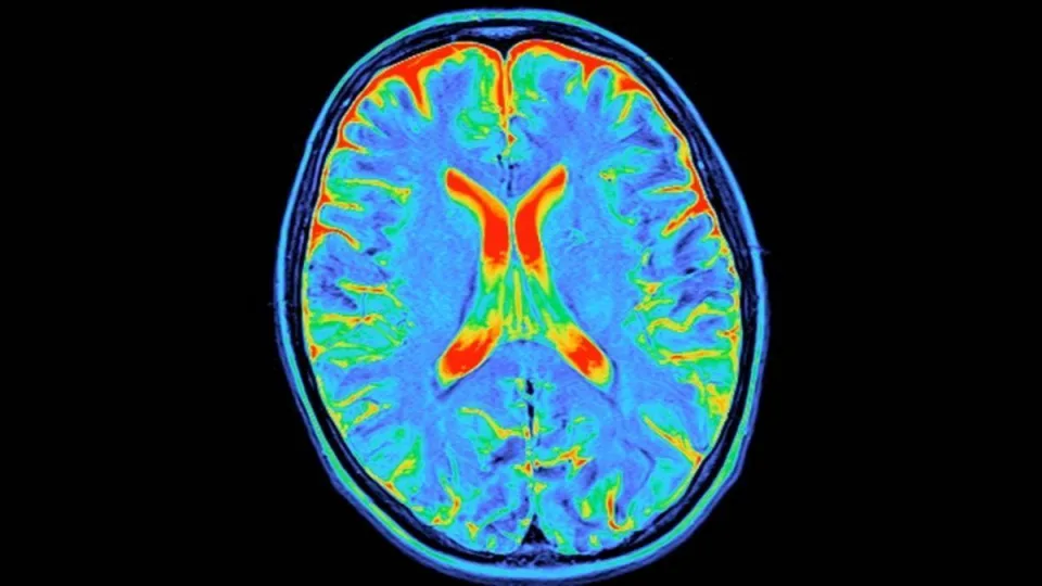 Keturi protinio gyvenimo lūžiai: atskleista, ką su jūsų smegenimis daro 9, 32, 66 ir 83 metų ribos
