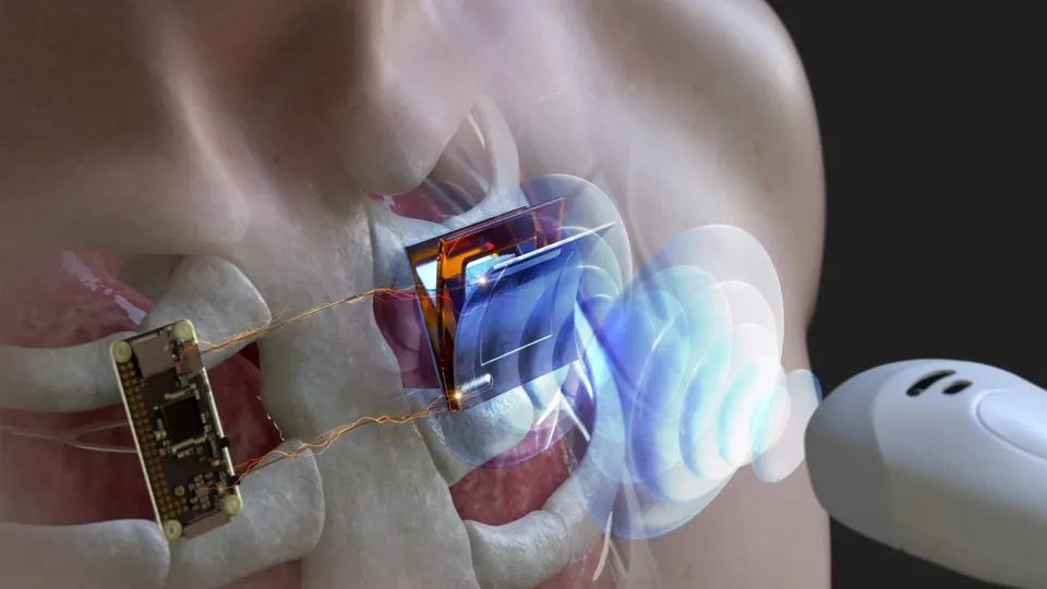 Pacientų laukia perversmas medicinoje: nauja technologija leis įkrauti širdies implantus be operacijos