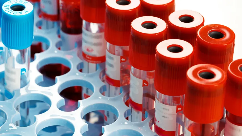 Ką apie tavo ateitį sako kraujas? Baltymai gali įspėti apie rizikas anksčiau nei gydytojai