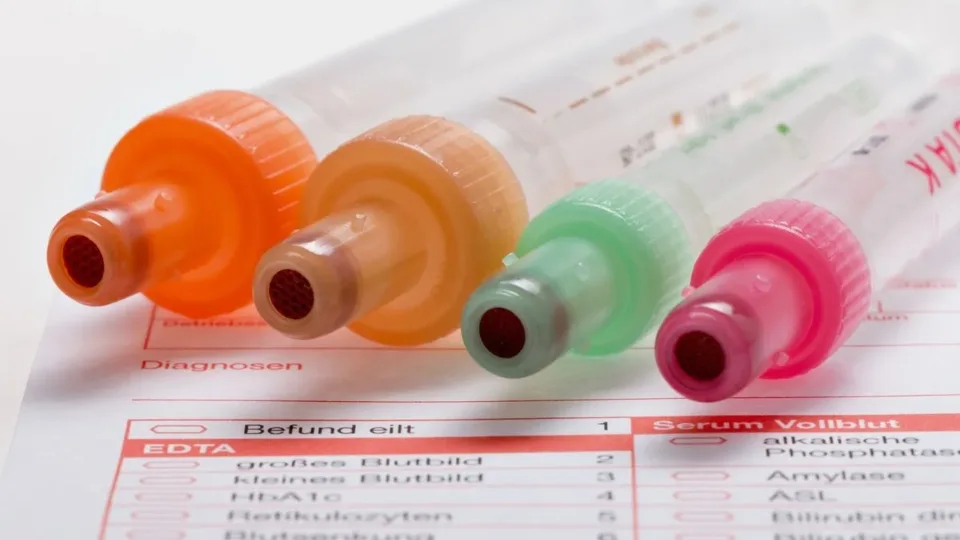 Nežinomas kraujo tipas sukėlė sumaištį: mokslininkai aptiko kraują, kurio nepažino net testai