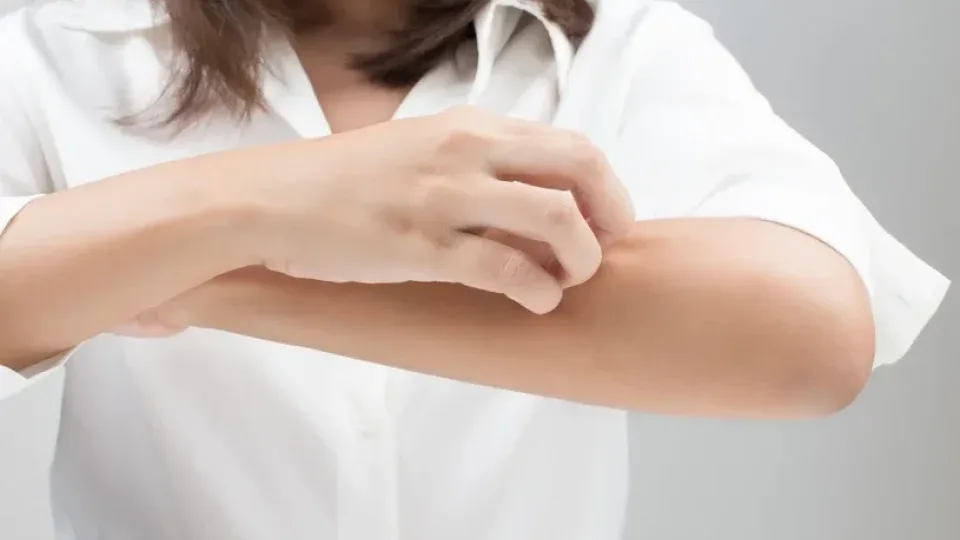 Sukando prie ežero ar upės? Štai kas padės numalšinti skausmą po mašalų įkandimo
