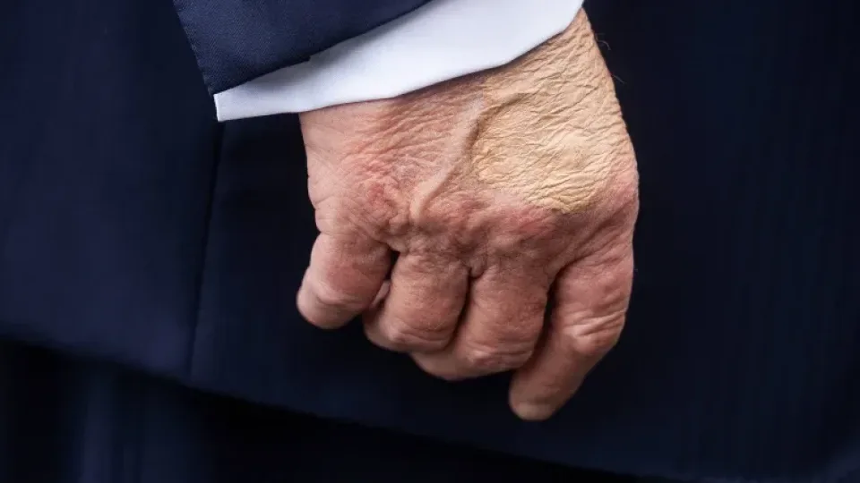 Ši liga iš pradžių atrodo lyg paprastas diskomfortas, tačiau tai gali būti pavojingos ligos pradžia