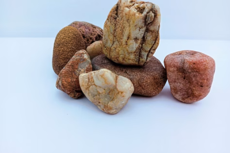 Šokiruojantis atradimas: inkstų akmenys nėra tokie nekenksmingai, kaip manėme iki šiol