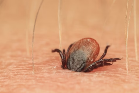 Po erkės įsisiurbimo praėjo savaitė: ne kiekviena erkė pavojinga, bet šių ženklų ignoruoti negalima