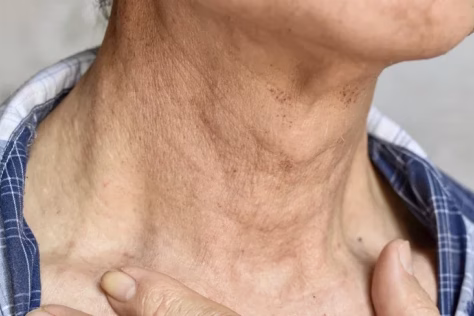 Kasdieniai įpročiai, kurie naikina odą greičiau nei laikas, kodėl jūsų kaklas sendina labiau nei veidas?