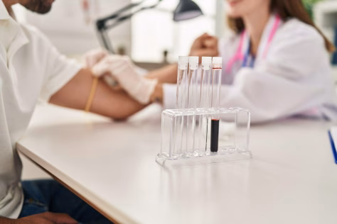 „Gerasis“ ir „blogasis“ cholesterolis: pasakė, kuo jie skiriasi ir kodėl abiejų rodikliai vienodai svarbūs
