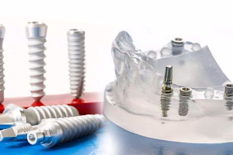 Ar dantų implantai iš tiesų gali tarnauti visą gyvenimą? Gydytojas paaiškino, kaip yra iš tikrųjų