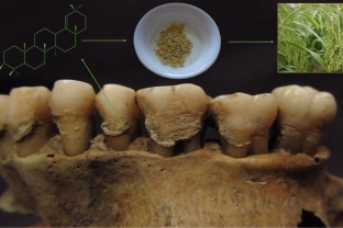 Kas slypi mūsų dantyse? Lietuvių mokslininkai prisidėjo prie pasaulinio proveržio