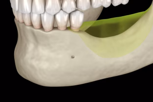 Danties netekimas yra tarsi tiksintis laikrodis: pasakė, ko daugelis mūsų nėra girdėję iki šiandienos