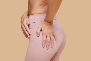 Ką sėdmenų forma sako apie jus? Mokslininkai perspėja, kadji gali išduoti rimtas ligas