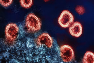 Pasveikote, bet pavojus liko? Mokslas atskleidė nerimą keliančius COVID pėdsakus