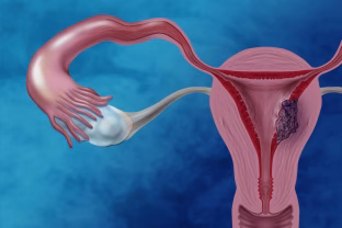 Endometriumo vėžio priežastis tyrinėjanti būsima mokslininkė: „Vėžio biologija susidomėjau dar mokykloje“