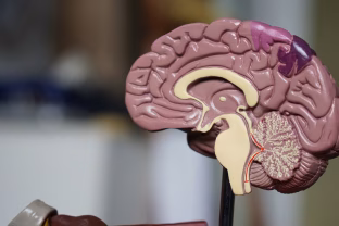 Mokslininkai rado natūralų būdą, galintį sustabdyti Alzheimerį, realus poveikis smegenims stulbina