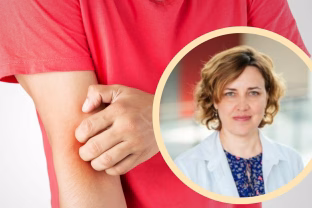 Kaip atskirti dilgėlinę nuo kitų ligų? Gydytojai paaiškino, kada tai slepia rimtesnę ligą nei galvojate