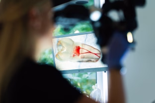 Šis gydymas dažnai lieka nesuprastas: sužinokite, ką iš tiesų veikia gydytojas endodontologas