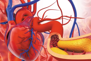 Ekspertai šokiruoti: kasdien darote tai, kas per kelerius metus gali sukelti hipertenziją