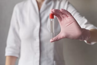 Vienas kraujo lašas gali išgelbėti gyvybę: šis testas aptinka 50 vėžio rūšių dar prieš simptomus