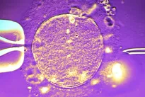 Tylus genetinis paveldas: kritinė spermos donoro klaida, dėl kurios kenčia šimtai šeimų