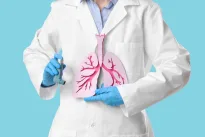 Tuberkuliozė vis dar žudo tyliai – gydytoja atskleidė, kas šiandien gelbsti iš tikrųjų