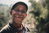 Šokiruojantis tyrimas: dantų būklė gali atskleisti, ar mirsite anksčiau laiko