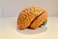 Neįtikėtina hipotezė: vėžys gali stabdyti Alzheimerio ligą, teigia nauji tyrimai