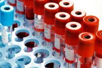 Ką apie tavo ateitį sako kraujas? Baltymai gali įspėti apie rizikas anksčiau nei gydytojai